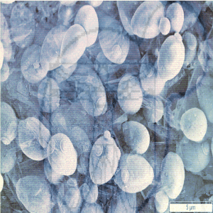 an image of yeast cells under a microscope